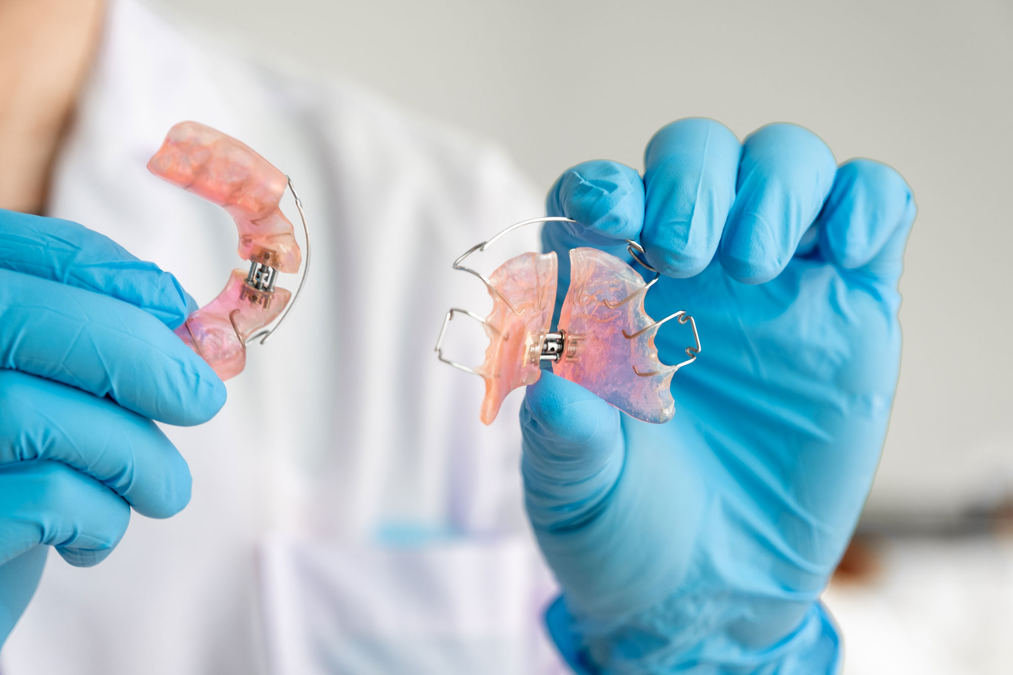 Eine Person mit blauen medizinischen Handschuhen hält zwei rosa-transparente lose Zahnspangen mit Metalldrähten in den Händen. Die Person trägt einen weißen Kittel, der Hintergrund ist unscharf.